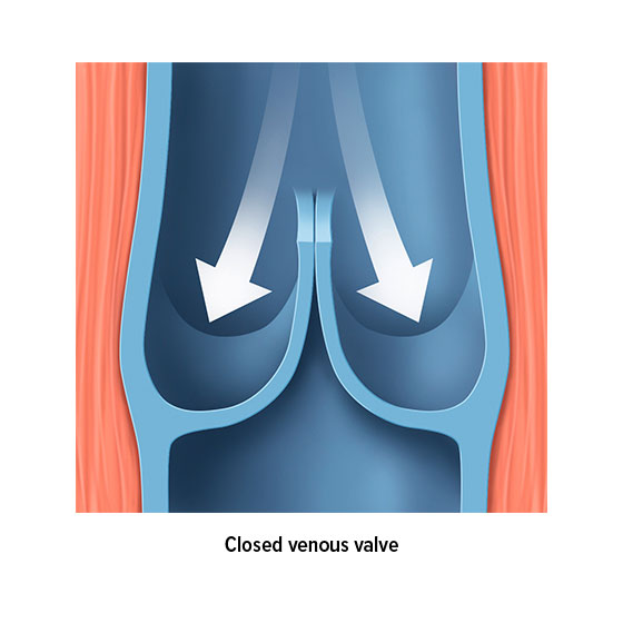 Closed venous valve Closed venous valve